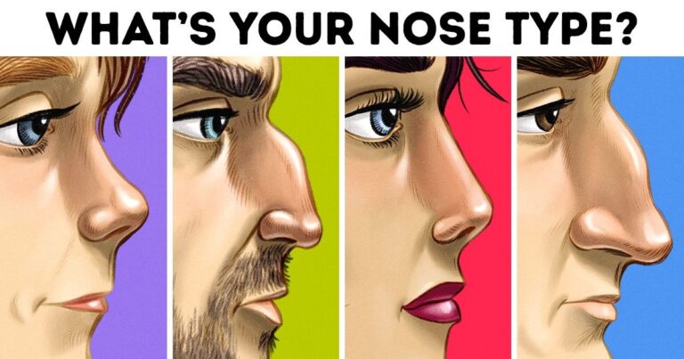 Guess the type of nose