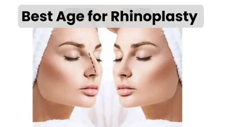 WHAT AGE CAN YOU GET RHINOPLASTY (NOSE JOB) IN THE US?