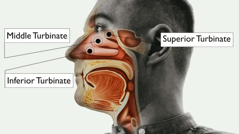 Nasal Turbinate Hypertrophy – Symptoms, Causes, Treatment And Surgery