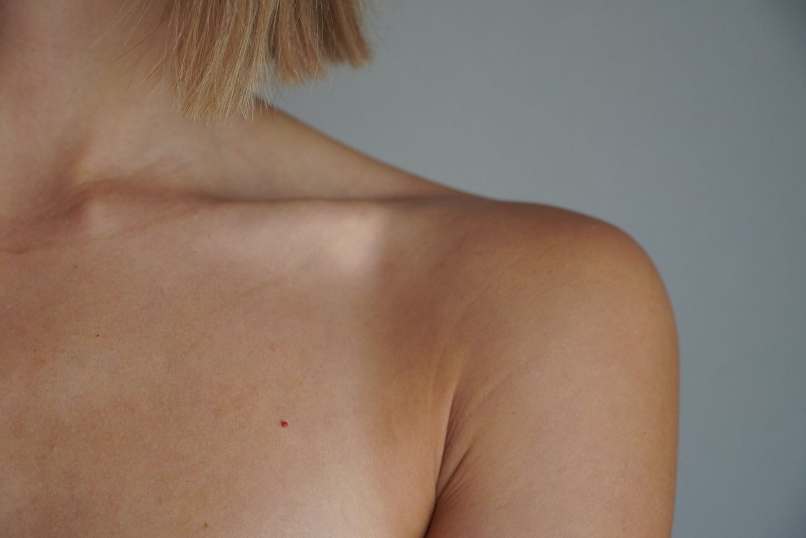 skin types, skin color types, dermatology conditions